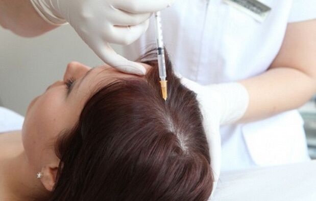 Mesoterapia emakumezkoen alopeziaren tratamenduan