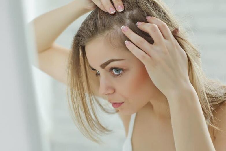 Neska batek alopezia fokuak aztertzen ditu